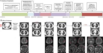 Positive response to trastuzumab deruxtecan in a patient with HER2-mutant NSCLC after multiple lines therapy, including T-DM1: a case report